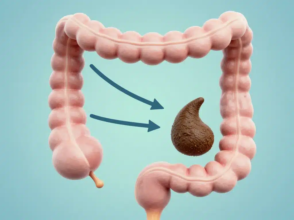 schéma stase stercorale colique blocage selles