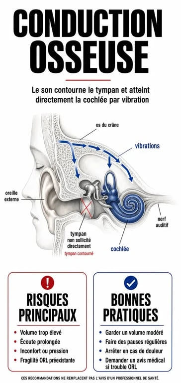 Danger des écouteurs conduction osseuse : schéma explicatif du fonctionnement et des risques pour l’audition